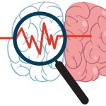 "النبضات الكهرومغناطيسية" علاج جديد لمرضى السكتة الدماغية