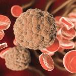 جلطات الدم بسبب لقاحات كوفيد