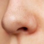 الرؤوس السوداء