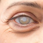 المياه الزرقاء